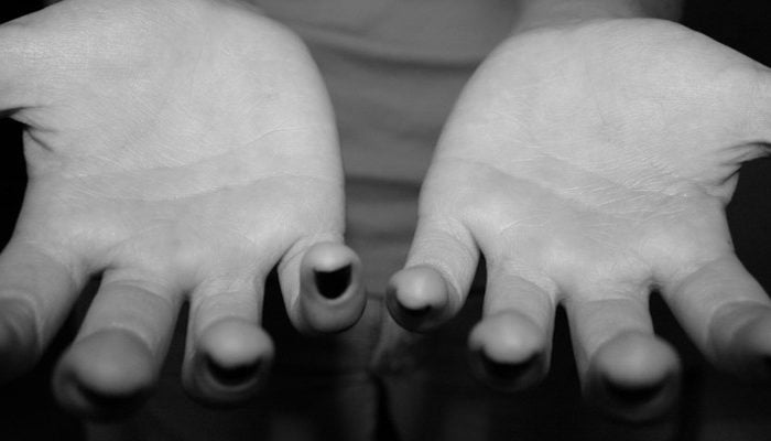 Reaching Out for Help from Human Trafficking