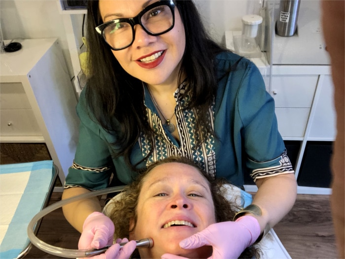DermaSweep Treatment for Face in Austin